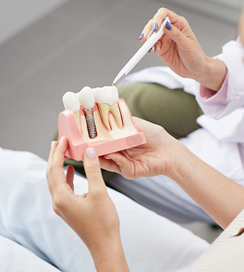 Dentist showing a model of a dental implant to a patient