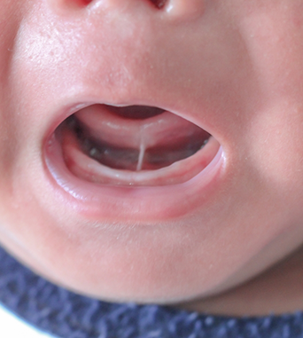 Close up of a baby opening their mouth