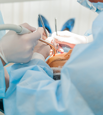 Close up of an oral surgeon treating a patient